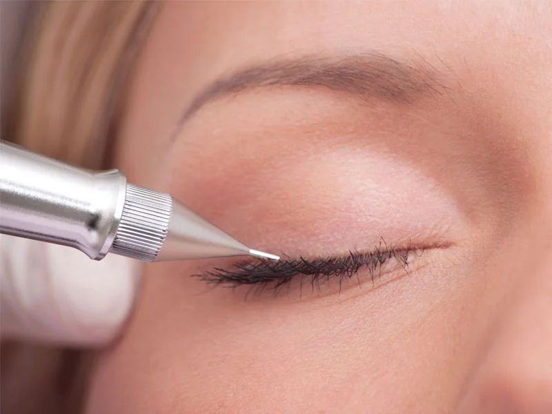 СНЯТИЕ ОТЕЧНОСТИ ВЕК ПОСЛЕ ТАТУАЖА И ПРАВИЛЬНЫЙ УХОД ЗА ВЕКАМИ