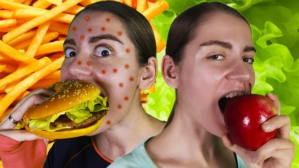 Продукты, которые портят кожу