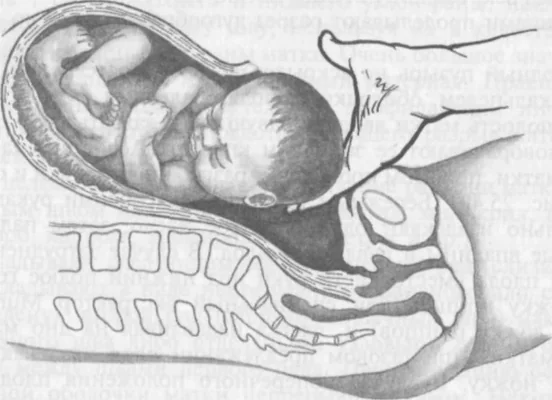 Роды окончены — что дальше?